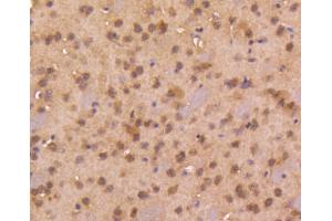 Paraformaldehyde-fixed, paraffin embedded mouse brain, Antigen retrieval by boiling in sodium citrate buffer (pH6) for 15min, Block endogenous peroxidase by 3% hydrogen peroxide for 30 minutes, Blocking buffer at 37°C for 20min, Antibody incubation with Smad4 (3A1) Monoclonal Antibody,  at 1:50 overnight at 4°C, followed by a conjugated secondary and DAB staining. (SMAD4 antibody)