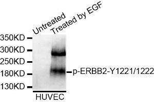 Western blot analysis of extracts of HUVEC cell line, using Phospho-ERBB2-Y1221/1222 antibody. (ErbB2/Her2 antibody  (pTyr1221, pTyr1222))