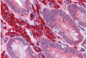 Human Small Intestine: Formalin-Fixed, Paraffin-Embedded (FFPE) (FOXO4 antibody  (N-Term))