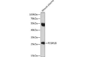 Western blot analysis of extracts of Mouse plasma, using FCGR1B antibody (ABIN7267161) at 1:1000 dilution.