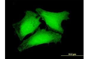 Immunofluorescence of purified MaxPab antibody to RPUSD3 on HeLa cell. (RPUSD3 antibody  (AA 1-343))