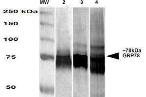 Western Blot analysis of Human, Mouse, Rat HEK-293, NIH3T3, and Rat Brain cell lysates showing detection of GRP78 protein using Mouse Anti-GRP78 Monoclonal Antibody, Clone 3G12-1G11 . (GRP78 antibody  (PE))