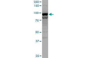 TNPO2 polyclonal antibody (A01), Lot # 060619JCS1. (TNPO2 antibody  (AA 201-300))