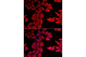 Immunofluorescence analysis of MCF7 cells using THRSP antibody (ABIN6129590, ABIN6149129, ABIN6149130 and ABIN6223067). (THRSP antibody  (AA 1-146))