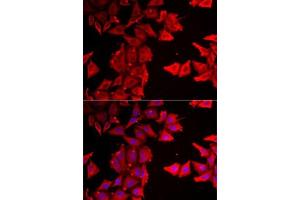 Immunofluorescence analysis of MCF7 cells using THRSP antibody (ABIN6129590, ABIN6149129, ABIN6149130 and ABIN6223067).