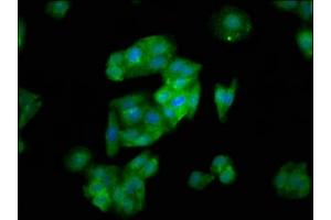 Immunofluorescence staining of HepG2 cells with ABIN7170211 at 1:133, counter-stained with DAPI. (SLC26A6 antibody  (AA 554-668))