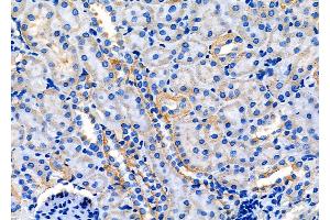 anti-Chromosome 17 Open Reading Frame 37 (C17orf37) (C-Term) antibody