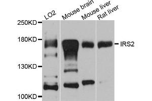 Western blot analysis of extracts of various cell lines, using IRS2 antibody (ABIN5974770) at 1/1000 dilution. (IRS2 antibody)