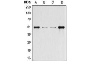 Western blot analysis of Beta-arrestin-1 (pS412) expression in HeLa (A), HEK293T (B), Raw264.