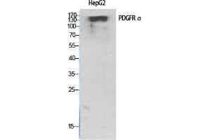 Western Blot (WB) analysis of specific cells using PDGFR-alpha Polyclonal Antibody. (PDGFRA antibody  (C-Term))