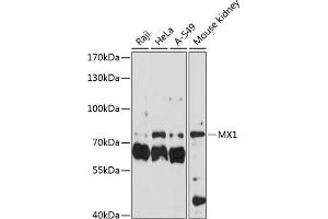 Western blot analysis of extracts of various cell lines, using MX1 antibody (ABIN3022532, ABIN3022533, ABIN3022534 and ABIN6218886) at 1:3000 dilution.