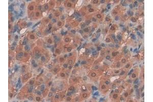 DAB staining on IHC-P; Samples: Rat Intestine Tissue (KIT Ligand antibody  (AA 27-259))