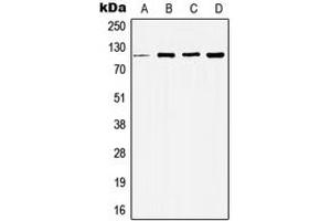 Western blot analysis of Histone Deacetylase 5 expression in MCF7 (A), HeLa (B), NIH3T3 (C), H9C2 (D) whole cell lysates. (HDAC5 antibody  (Center))