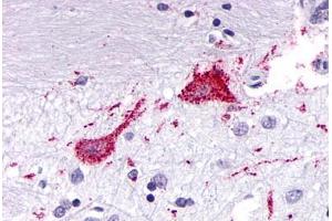Anti-KISS1R / GPR54 antibody  ABIN1048995 IHC staining of human brain, neurons and glia.