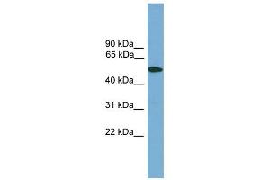 TMPRSS4 antibody used at 1 ug/ml to detect target protein. (TMPRSS4 antibody  (Middle Region))