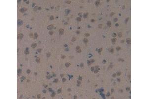 IHC-P analysis of brain tissue, with DAB staining.