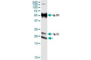 Immunoprecipitation of IFNE transfected lysate using anti-IFNE MaxPab rabbit polyclonal antibody and Protein A Magnetic Bead , and immunoblotted with IFNE MaxPab rabbit polyclonal antibody (D01) . (IFNE antibody  (AA 1-208))