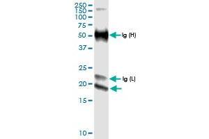 Immunoprecipitation of IFNE transfected lysate using anti-IFNE MaxPab rabbit polyclonal antibody and Protein A Magnetic Bead , and immunoblotted with IFNE MaxPab rabbit polyclonal antibody (D01) . (IFNE antibody  (AA 1-208))