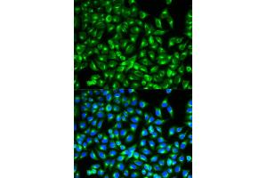 Immunofluorescence analysis of MCF-7 cells using CDC34 antibody.