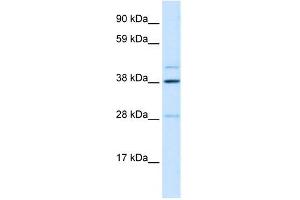WB Suggested Anti-LASS3 Antibody Titration: 0. (LASS3 antibody  (N-Term))