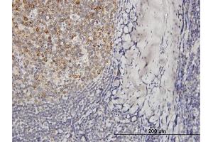 Immunoperoxidase of purified MaxPab antibody to VPREB3 on formalin-fixed paraffin-embedded human tonsil. (VPREB3 antibody  (AA 1-123))