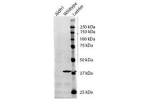 AP31099PU-N IDH1 antibody staining of S.