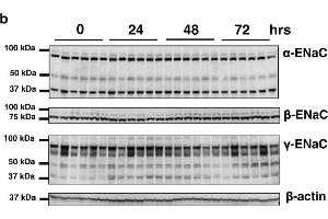 The expression of ENaC subunits after preservation in UW solution. (SCNN1A antibody  (AA 46-68))