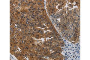 Immunohistochemistry of Human tonsil using PDCD2 Polyclonal Antibody at dilution of 1:50