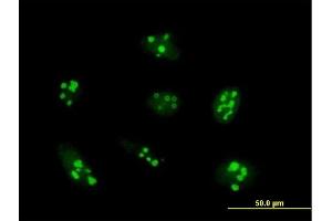 Immunofluorescence of purified MaxPab antibody to UTP14A on HeLa cell.