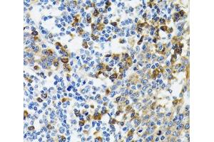 Immunohistochemistry of paraffin-embedded Human tonsil using HYOU1 Polyclonal Antibody at dilution of 1:100 (40x lens).