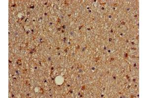 Immunohistochemistry of paraffin-embedded human brain tissue using ABIN7172631 at dilution of 1:100 (SOX4 antibody  (AA 1-60))