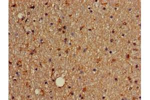 Immunohistochemistry of paraffin-embedded human brain tissue using ABIN7172631 at dilution of 1:100 (SOX4 antibody  (AA 1-60))