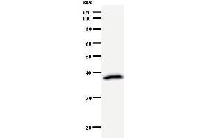 Western Blotting (WB) image for anti-RuvB-Like 1 (E. Coli) (RUVBL1) antibody (ABIN932457) (RUVBL1 antibody)