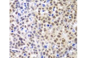 Immunohistochemistry of paraffin-embedded Mouse cancer using LHX4 Polyclonal Antibody at dilution of 1:100 (40x lens).