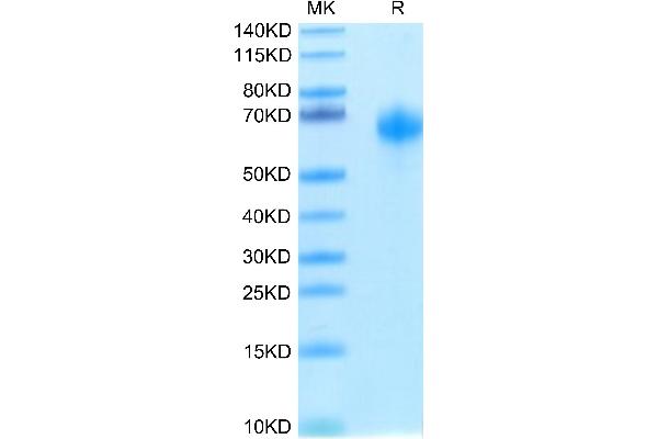 IL1RAP Protein (His-Avi Tag,Biotin)