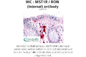 Image no. 1 for anti-Macrophage Stimulating 1 Receptor (C-Met-Related tyrosine Kinase) (MST1R) (Internal Region) antibody (ABIN1737097) (MST1R antibody  (Internal Region))