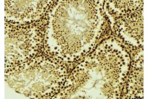 ABIN6275529 at 1/100 staining Mouse testis tissue by IHC-P. (STK36 antibody  (Internal Region))