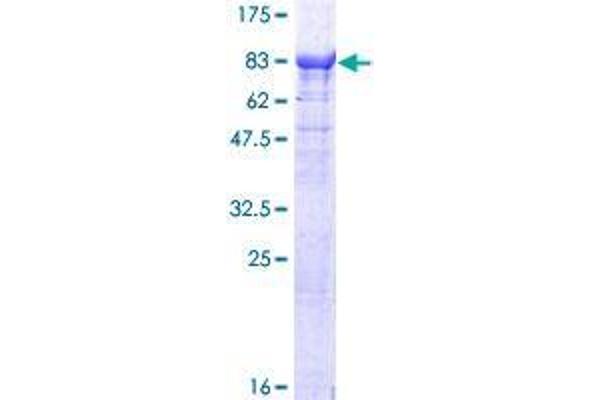 TTC30B Protein (AA 1-665) (GST tag)