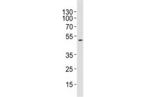 Western blot analysis of lysate from HT-29 cell line using AURKA antibody at 1:1000. (Aurora A antibody)