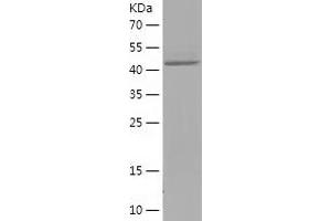 Western Blotting (WB) image for PSMC3 Interacting Protein (PSMC3IP) (AA 21-217) protein (His-IF2DI Tag) (ABIN7284093) (PSMC3IP Protein (AA 21-217) (His-IF2DI Tag))