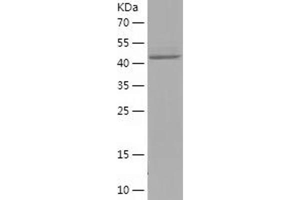 PSMC3IP Protein (AA 21-217) (His-IF2DI Tag)