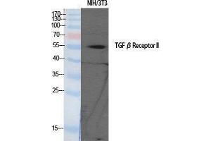 Western Blotting (WB) image for anti-Transforming Growth Factor, beta Receptor II (70/80kDa) (TGFBR2) (Tyr159) antibody (ABIN3187247) (TGFBR2 antibody  (Tyr159))