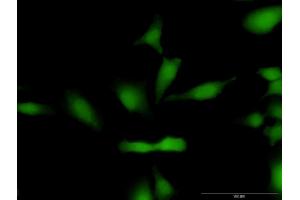 Immunofluorescence of purified MaxPab antibody to CCND1 on HeLa cell. (Cyclin D1 antibody  (AA 1-295))