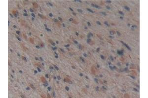 Immunohistochemistry (IHC) image for anti-Microtubule-Associated Protein tau (MAPT) (AA 130-386) antibody (ABIN7434476)