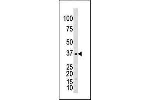 The anti-GALK1 Pab (ABIN391114 and ABIN2841244) is used in Western blot to detect GALK1 in Y79 cell lysate. (GALK1 antibody  (C-Term))
