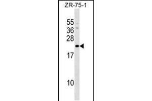Western blot analysis in ZR-75-1 cell line lysates (35ug/lane). (GRPEL1 antibody  (AA 116-142))
