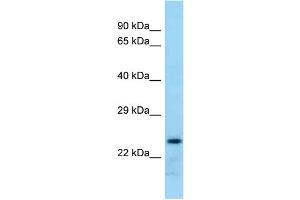 WB Suggested Anti-Rab17 Antibody Titration: 1. (RAB17 antibody  (Middle Region))