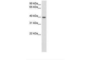 ITGB1BP2 antibody  (N-Term)