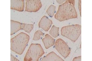 IHC-P analysis of Rat Tissue, with DAB staining. (TNNT1 antibody  (AA 1-228))