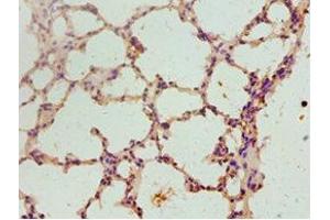 Immunohistochemistry of paraffin-embedded mouse lung tissue using ABIN7152800 at dilution of 1:100 (FGF2 antibody  (AA 143-288))